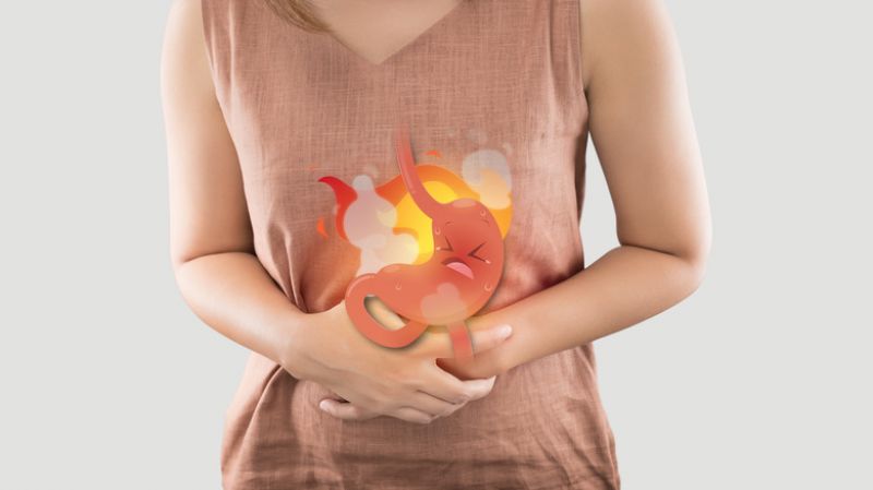 chứng ợ nóng chứng ợ nóng